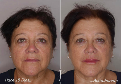 Coláurea™ Bálsamo Antiarrugas – ¡Adiós Arrugas!